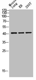 Western blot analysis of mouse-lung KB 293T lysis using MEK-2 antibody.