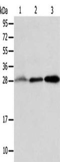 Gel: 12%SDS-PAGE, Lysate: 40 ug, Lane 1-3: Human fetal liver tissue, Human seminoma tissue, RAW264.7 cells, Primary antibody: CSB-PA031205(ALKBH2 Antibody) at dilution 1/800, Secondary antibody: Goat anti rabbit IgG at 1/8000 dilution, Exposure time: 2 minutes