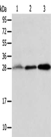 Gel: 12%SDS-PAGE, Lysate: 40 ug, Lane 1-3: Human fetal liver tissue, Human seminoma tissue, RAW264.7 cells, Primary antibody: CSB-PA031205(ALKBH2 Antibody) at dilution 1/800, Secondary antibody: Goat anti rabbit IgG at 1/8000 dilution, Exposure time: 2 minutes