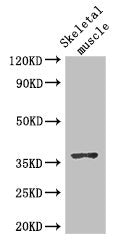 Western Blot
Positive WB detected in: Mouse skeletal muscle tissue
All lanes: DNAJB6 antibody at 2.8ug/ml
Secondary
Goat polyclonal to rabbit IgG at 1/50000 dilution
Predicted band size: 37, 27, 36, 31 kDa
Observed band size: 37 kDa