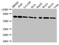 Western Blot
Positive WB detected in: HEK293 whole cell lysate, A549 whole cell lysate, Colo320 whole cell lysate, Hela whole cell lysate, HepG2 whole cell lysate, Mouse brain tissue, Rat brain tissue, Rat lung tissue
All lanes: HSPA8 antibody at 3.5µg/ml
Secondary
Goat polyclonal to rabbit IgG at 1/50000 dilution
Predicted band size: 71, 54 kDa
Observed band size: 71 kDa