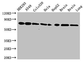 Western Blot
Positive WB detected in: HEK293 whole cell lysate, A549 whole cell lysate, Colo320 whole cell lysate, Hela whole cell lysate, HepG2 whole cell lysate, Mouse brain tissue, Rat brain tissue, Rat lung tissue
All lanes: HSPA8 antibody at 3.5µg/ml
Secondary
Goat polyclonal to rabbit IgG at 1/50000 dilution
Predicted band size: 71, 54 kDa
Observed band size: 71 kDa