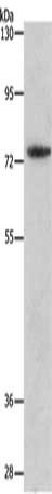 Gel: 8%SDS-PAGE, Lysate: 40 ug, Lane: Mouse heart tissue, Primary antibody: CSB-PA032714(MMP15 Antibody) at dilution 1/250, Secondary antibody: Goat anti rabbit IgG at 1/8000 dilution, Exposure time: 90 seconds