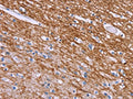 The image on the left is immunohistochemistry of paraffin-embedded Human brain tissue using CSB-PA033129(CRH Antibody) at dilution 1/20, on the right is treated with synthetic peptide. (Original magnification: ×200)