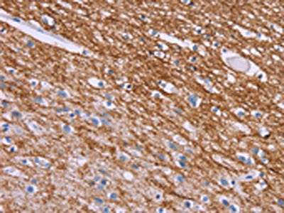 The image on the left is immunohistochemistry of paraffin-embedded Human brain tissue using CSB-PA033129(CRH Antibody) at dilution 1/20, on the right is treated with synthetic peptide. (Original magnification: ×200)