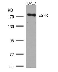 Western blot analysis of extracts from HUVEC cells using EGFR(Ab-1172) Antibody.
