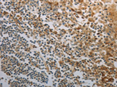 The image on the left is immunohistochemistry of paraffin-embedded Human tonsil tissue using CSB-PA033184(INHA Antibody) at dilution 1/150, on the right is treated with fusion protein. (Original magnification: ×200)