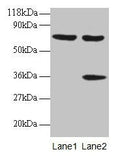 Western blot
All lanes: SYNCRIP antibody at 2µg/ml
Lane 1: EC109 whole cell lysate
Lane 2: 293T whole cell lysate
Secondary
Goat polyclonal to rabbit IgG at 1/15000 dilution
Predicted band size: 70, 66, 63, 59, 47 kDa
Observed band size: 70, 36 kDa
