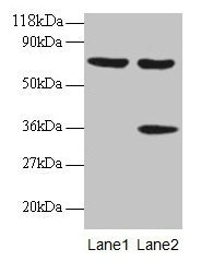 Western blot
All lanes: SYNCRIP antibody at 2µg/ml
Lane 1: EC109 whole cell lysate
Lane 2: 293T whole cell lysate
Secondary
Goat polyclonal to rabbit IgG at 1/15000 dilution
Predicted band size: 70, 66, 63, 59, 47 kDa
Observed band size: 70, 36 kDa
