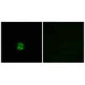 Immunofluorescence analysis of A549 cells, using CHST6 antibody.
