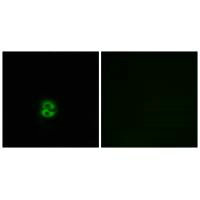 Immunofluorescence analysis of A549 cells, using CHST6 antibody.