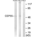 Western blot analysis of extracts from HUVEC cells and HeLa cells, using CEP55 antibody.