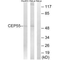 Western blot analysis of extracts from HUVEC cells and HeLa cells, using CEP55 antibody.
