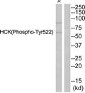 Western blot analysis of extracts from JurKat cells using HCK (Phospho-Tyr522) Antibody.The lane on the right is treated with the antigen-specific peptide.