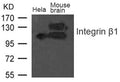 Western blot analysis of extract from Mouse brain tissue and Hela cells using Integrin b1(CD29) Antibody
