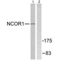 Western blot analysis of extracts from MDA-MB-435 cells, using NCoR1 antibody.