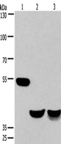 Gel: 6%SDS-PAGE, Lysate: 40 ug, Lane 1-3: Mouse brain tissue, human fetal muscle tissue, mouse heart tissue, Primary antibody: CSB-PA035641(CABLES1 Antibody) at dilution 1/650, Secondary antibody: Goat anti rabbit IgG at 1/8000 dilution, Exposure time: 30 seconds