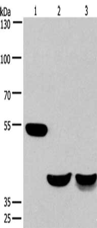 Gel: 6%SDS-PAGE, Lysate: 40 ug, Lane 1-3: Mouse brain tissue, human fetal muscle tissue, mouse heart tissue, Primary antibody: CSB-PA035641(CABLES1 Antibody) at dilution 1/650, Secondary antibody: Goat anti rabbit IgG at 1/8000 dilution, Exposure time: 30 seconds