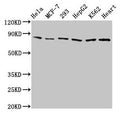 Western Blot
Positive WB detected in: Hela whole cell lysate, MCF-7 whole cell lysate, 293 whole cell lysate, HepG2 whole cell lysate, K562 whole cell lysate, Mouse heart tissue
All lanes: TRAP1 antibody at 2µg/ml
Secondary
Goat polyclonal to rabbit IgG at 1/50000 dilution
Predicted band size: 81, 75 kDa
Observed band size: 81 kDa