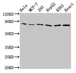 Western Blot
Positive WB detected in: Hela whole cell lysate, MCF-7 whole cell lysate, 293 whole cell lysate, HepG2 whole cell lysate, K562 whole cell lysate, Mouse heart tissue
All lanes: TRAP1 antibody at 2µg/ml
Secondary
Goat polyclonal to rabbit IgG at 1/50000 dilution
Predicted band size: 81, 75 kDa
Observed band size: 81 kDa
