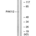 Western blot analysis of extracts from K562 cells, using PAK1/2 (Ab-199) antibody.