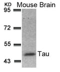 Western blot analysis of extracts from Mouse Brain tissue using Tau(Ab-181) Antibody.