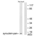 Western blot analysis of extracts from rat heart, using Synuclein-pan antibody.