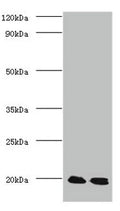 Western blot
All lanes: Protein DJ-1 antibody at 2ug/ml
Lane 1: EC109 whole cell lysate
Lane 2: 293T whole cell lysate
Secondary
Goat polyclonal to Rabbit IgG at 1/15000 dilution
Predicted band size: 20 kDa
Observed band size: 20 kDa