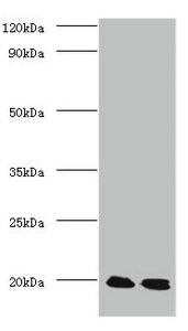 Western blot
All lanes: Protein DJ-1 antibody at 2ug/ml
Lane 1: EC109 whole cell lysate
Lane 2: 293T whole cell lysate
Secondary
Goat polyclonal to Rabbit IgG at 1/15000 dilution
Predicted band size: 20 kDa
Observed band size: 20 kDa