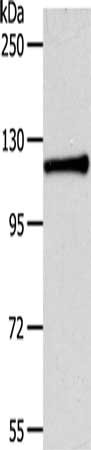 Gel: 8%SDS-PAGE, Lysate: 40 ug, Lane: HepG2 cells, Primary antibody: CSB-PA037292(CDH3 Antibody) at dilution 1/100, Secondary antibody: Goat anti rabbit IgG at 1/8000 dilution, Exposure time: 1 minute
