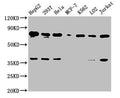 Western Blot
Positive WB detected in: HepG2 whole cell lysate, 293T whole cell lysate, Hela whole cell lysate, MCF-7 whole cell lysate, K562 whole cell lysate, LO2 whole cell lysate, Jurkat whole cell lysate
All lanes: UBC antibody at 1:2000
Secondary
Goat polyclonal to rabbit IgG at 1/50000 dilution
Predicted band size: 78 kDa
Observed band size: 78 kDa