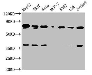 Western Blot
Positive WB detected in: HepG2 whole cell lysate, 293T whole cell lysate, Hela whole cell lysate, MCF-7 whole cell lysate, K562 whole cell lysate, LO2 whole cell lysate, Jurkat whole cell lysate
All lanes: UBC antibody at 1:2000
Secondary
Goat polyclonal to rabbit IgG at 1/50000 dilution
Predicted band size: 78 kDa
Observed band size: 78 kDa
