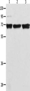 Gel: 10%SDS-PAGE, Lysate: 40 ug, Lane 1-3: 293T cells, K562 cells, Jurkat cells, Primary antibody: CSB-PA037612(RELA Antibody) at dilution 1/500, Secondary antibody: Goat anti rabbit IgG at 1/8000 dilution, Exposure time: 5 seconds
