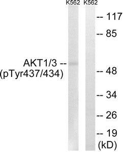 Western blot analysis of extracts from K562 cells, treated with insulin (0.01U/ml, 15mins), using AKT1/3 (Phospho-Tyr437/434) antibody. The lane on the right is treated with the synthesized peptide.