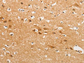 The image on the left is immunohistochemistry of paraffin-embedded Human brain tissue using CSB-PA038132(CDH6 Antibody) at dilution 1/50, on the right is treated with fusion protein. (Original magnification: ×200)
