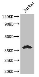 Western Blot
Positive WB detected in: Jurkat whole cell lysate
All lanes: MCL1 antibody at 3.2ug/ml
Secondary
Goat polyclonal to rabbit IgG at 1/50000 dilution
Predicted band size: 38, 29 kDa
Observed band size: 38 kDa