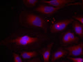 Immunofluorescence staining of methanol-fixed HeLa cells using NF-kappa;B p100(phospho-Ser870) antibody.