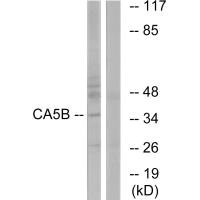 Western blot analysis of extracts from NIH/3T3 cells, using CA5B antibody.