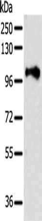 Gel: 8%SDS-PAGE, Lysate: 40 ug, Lane: Jurkat cells, Primary antibody: CSB-PA039114(PSMD2 Antibody) at dilution 1/400, Secondary antibody: Goat anti rabbit IgG at 1/8000 dilution, Exposure time: 1 minute