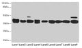 Western blot
All lanes: DNAJB1 antibody at 3µg/ml
Lane 1: Mouse spleen tissue
Lane 2: Colo320 whole cell lysate
Lane 3: Hela whole cell lysate
Lane 4: LO2 whole cell lysate
Lane 5: HepG2 whole cell lysate
Lane 6: HT29 whole cell lysate
Lane 7: A549 whole cell lysate
Lane 8: Jurkat whole cell lysate
Lane 9: MCF-7 whole cell lysate
Secondary
Goat polyclonal to rabbit IgG at 1/10000 dilution
Predicted band size: 39, 28 kDa
Observed band size: 39 kDa