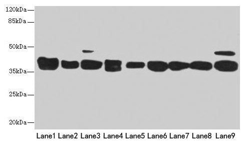Western blot
All lanes: DNAJB1 antibody at 3µg/ml
Lane 1: Mouse spleen tissue
Lane 2: Colo320 whole cell lysate
Lane 3: Hela whole cell lysate
Lane 4: LO2 whole cell lysate
Lane 5: HepG2 whole cell lysate
Lane 6: HT29 whole cell lysate
Lane 7: A549 whole cell lysate
Lane 8: Jurkat whole cell lysate
Lane 9: MCF-7 whole cell lysate
Secondary
Goat polyclonal to rabbit IgG at 1/10000 dilution
Predicted band size: 39, 28 kDa
Observed band size: 39 kDa
