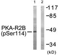 Western blot analysis of extracts from COS-7 cells treated with PMA using PKA-R2β (Phospho-Ser114) Antibody.The lane on the right is treated with the antigen-specific peptide.