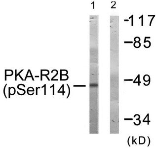 Western blot analysis of extracts from COS-7 cells treated with PMA using PKA-R2β (Phospho-Ser114) Antibody.The lane on the right is treated with the antigen-specific peptide.