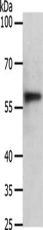 Gel: 10%SDS-PAGE, Lysate: 40 ug, Lane: Jurkat cells, Primary antibody: CSB-PA039868(ABCD4 Antibody) at dilution 1/300, Secondary antibody: Goat anti rabbit IgG at 1/8000 dilution, Exposure time: 40 seconds