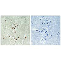 Immunohistochemistry analysis of paraffin-embedded human brain tissue using GADD45GIP1 antibody.
