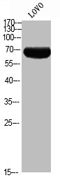 Phospho-RPS6KB1 (T444) Antibody – Figure 1 of 1
