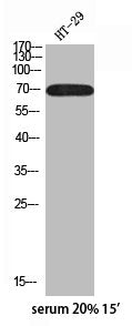 Phospho-RPS6KB1 (S418) Antibody – Figure 1 of 1