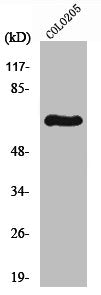 RPS6KB1 Antibody – Figure 1 of 1