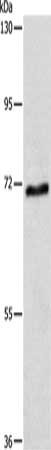 Gel: 8%SDS-PAGE, Lysate: 40 ug, Lane: Mouse brain tissue, Primary antibody: CSB-PA040368(ABCG4 Antibody) at dilution 1/400, Secondary antibody: Goat anti rabbit IgG at 1/8000 dilution, Exposure time: 1 minute