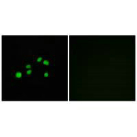 Immunofluorescence analysis of HepG2 cells, using Collagen XXIII α1 antibody.